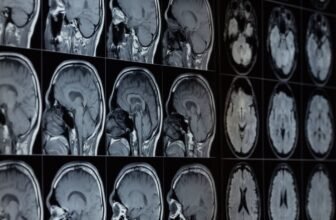 Our Brains Include Lithium—and Its Loss May Assist Drive Alzheimer’s, Examine Finds